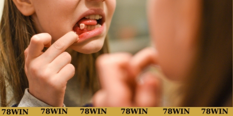 Giải mã chiêm bao nằm mơ thấy rụng răng