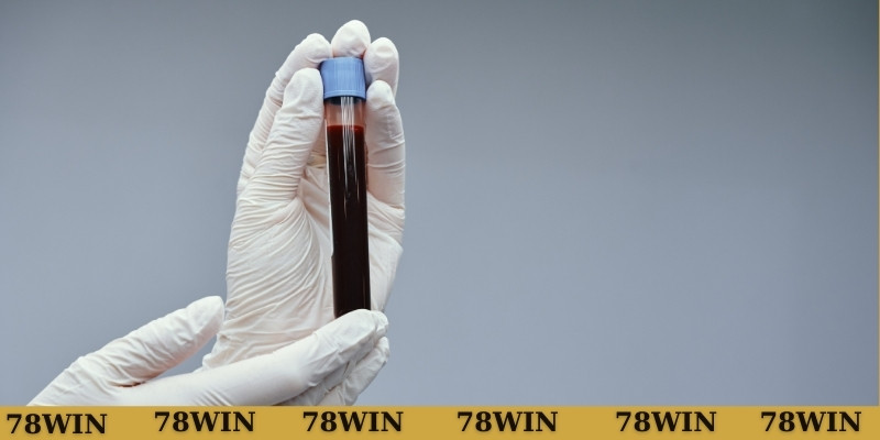 Gợi ý lô đẹp khi thắc mắc nằm mơ thấy máu đỏ đánh số gì