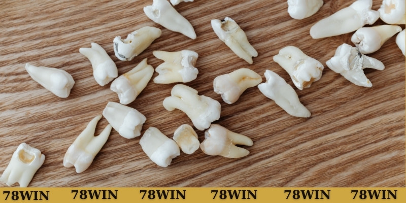 Mơ thấy bố rụng răng có nhiều ý nghĩa